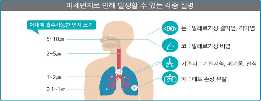 미세먼지로 인해 발생할 수 있는 각종 질병을 설명한 그림으로  눈: 알레르기성 결막염,각막염 코: 알레르기성 비염 기관지: 기관지염, 폐기종, 천식 폐: 폐포 손상 유발 체내에 흡수가능한 먼지크기는 코: 5~ 10 마이크로미터 목: 2~5 마이크로미터 기관지: 1~1 마이크로미터 폐: 0.1~ 1 마이크로미터